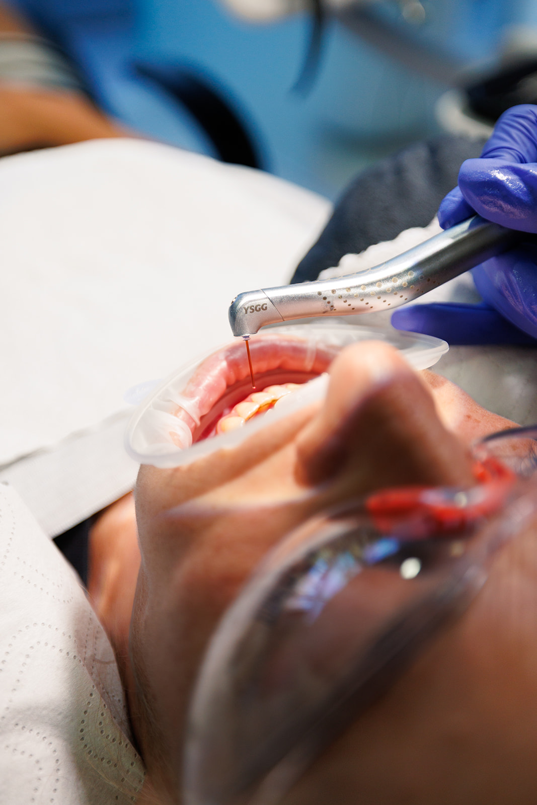 Dental Implants